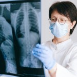 photo of doctor holding x ray result