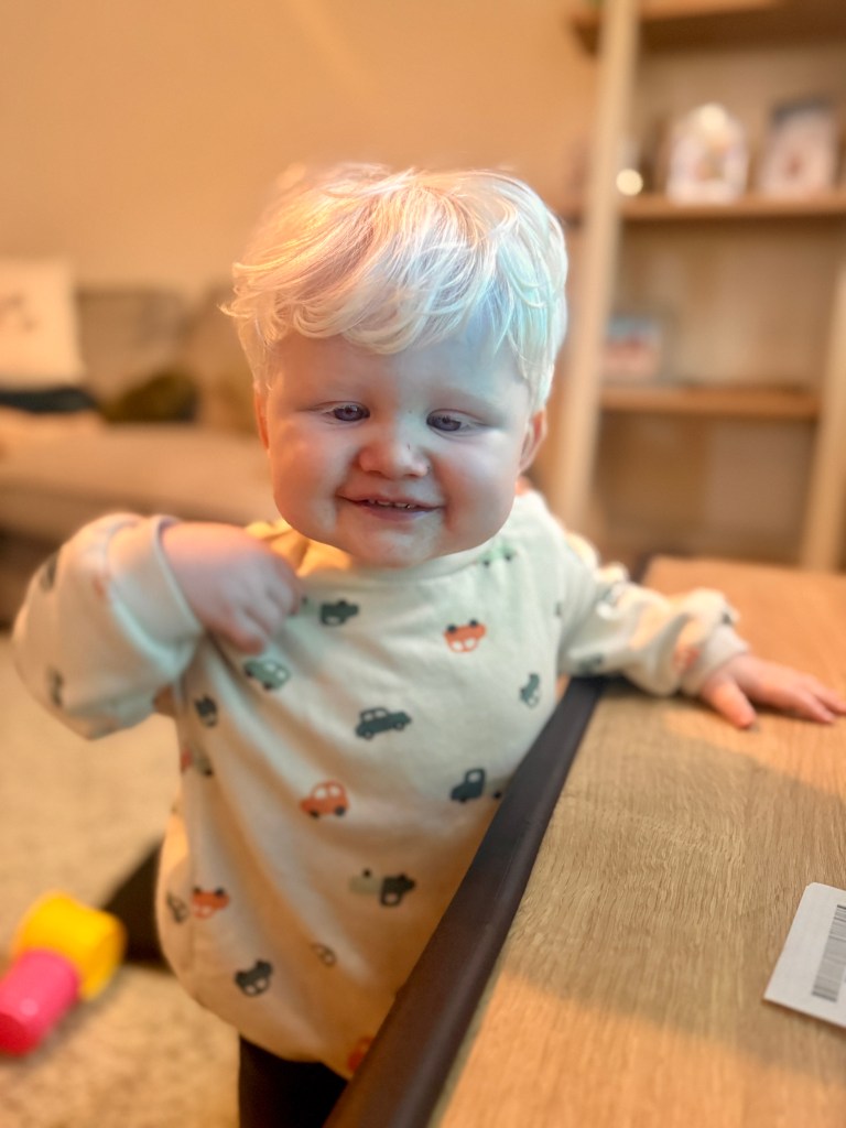 Young child with albinism smiling while standing beside a table in a family living room.