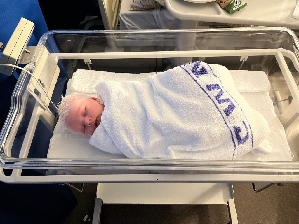 Newborn baby with albinism resting in a hospital bassinet shortly after birth.
