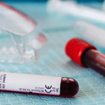 Two vials of blood on a surgical table