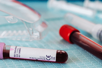 Two vials of blood on a surgical table