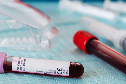 Two vials of blood on a surgical table