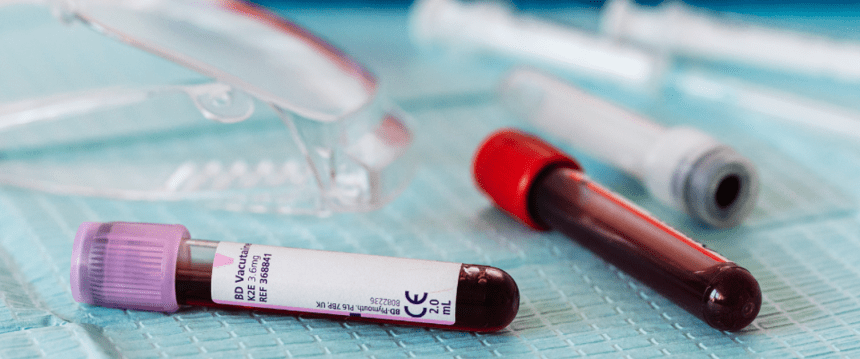 Two vials of blood on a surgical table