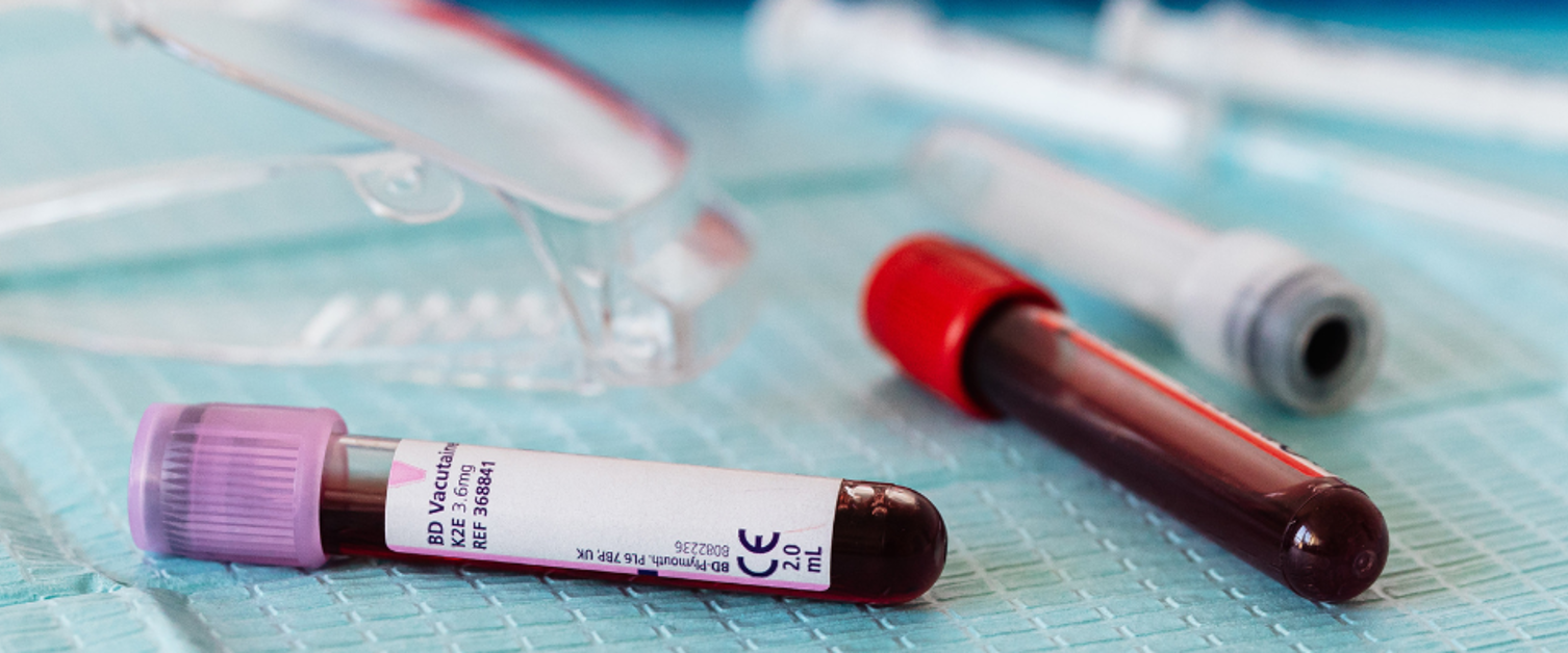 Two vials of blood on a surgical table