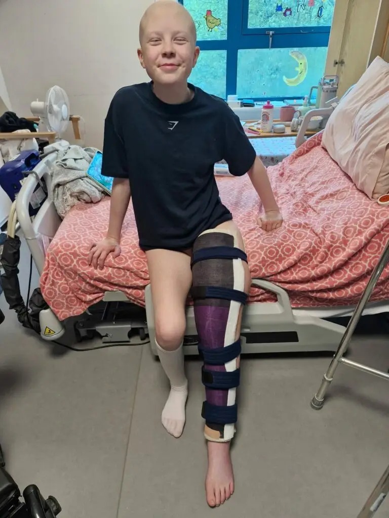 Soffia sitting on a hospital bed with a full-leg cast held by straps