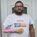 Brad Griffiths, a bearded man in glasses and a white T-shirt, standing at a front door wearing a pink patterned prosthetic right arm