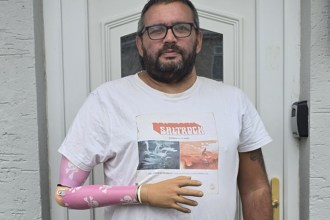 Brad Griffiths, a bearded man in glasses and a white T-shirt, standing at a front door wearing a pink patterned prosthetic right arm