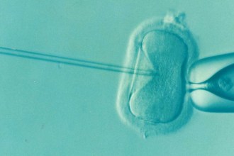 Microscope image of IVF treatment, with a needle injecting an egg cell held by a pipette